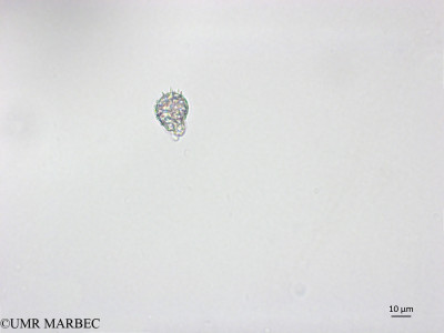 phyto/Brazilian_Nordeste/FernandodeNoronha_station1/ABRACOS1 October 2015/Syracosphaera pulchra (Snap-1023)(copy)_thumb.jpg